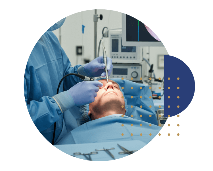 Procedimento cirúrgico de sinusite